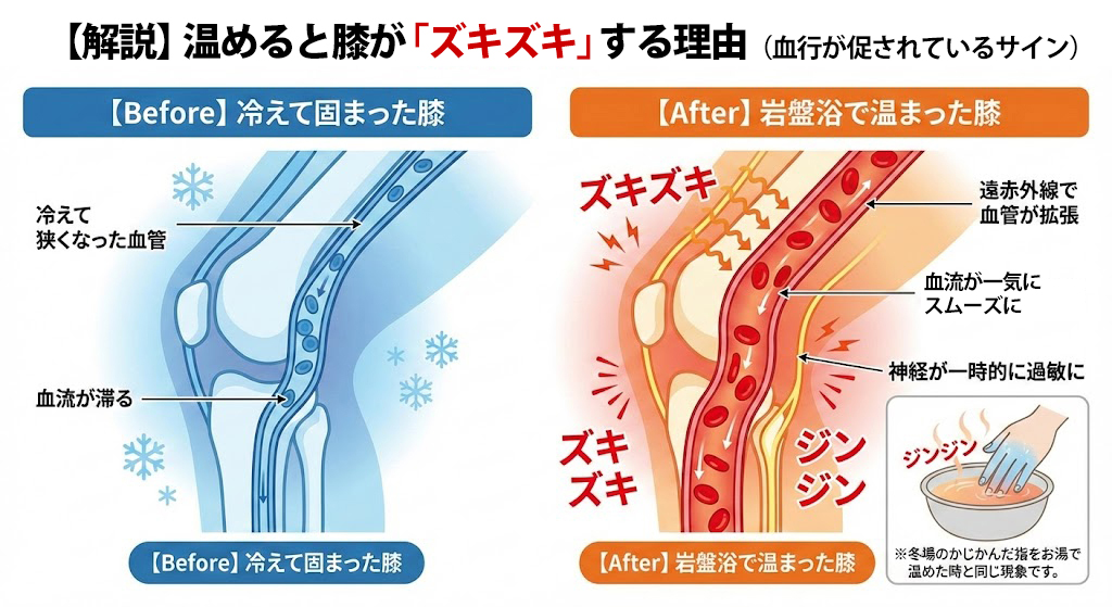 岩盤浴で膝を温めるとズキズキする理由の図解。冷えて狭くなった血管が遠赤外線で拡張し、血流が一気に促されることで神経が過敏になる「体が順応しようとしているサイン」であることを、かじかんだ指をお湯で温める現象に例えて解説しています。